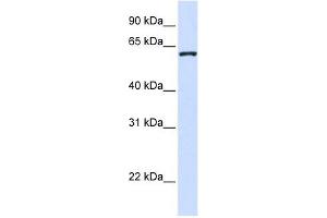 WDR40A antibody used at 1 ug/ml to detect target protein. (DCAF12 antibody  (Middle Region))