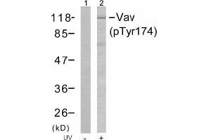 Image no. 1 for anti-Vav 1 Oncogene (VAV1) (pTyr174) antibody (ABIN196856) (VAV1 antibody  (pTyr174))