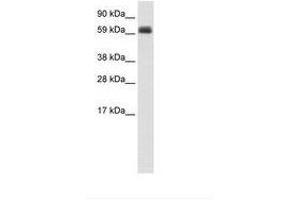 Image no. 1 for anti-T-Bet (AA 36-85) antibody (ABIN202727) (T-Bet antibody  (AA 36-85))