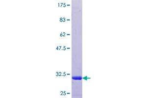 Thymosin beta 4, X-Linked Pseudogene 8 (TMSB4XP8) (AA 1-44) protein (GST tag)