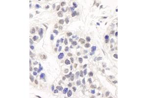 Immunohistochemistry (IHC) image for anti-DNA Cross-Link Repair 1C (DCLRE1C) (C-Term) antibody (ABIN7454515) (DCLRE1C antibody  (C-Term))