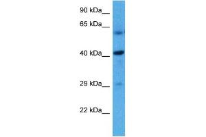 Host:  Rat  Target Name:  HSD11B2  Sample Tissue:  Rat Liver  Antibody Dilution:  1ug/ml (HSD11B2 antibody  (N-Term))