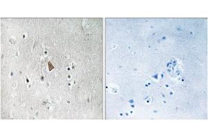 Immunohistochemistry analysis of paraffin-embedded human brain tissue, using Insulin Like Growth Factor 1 Receptor (IGF1R) (Phospho-Tyr1346) antibody.