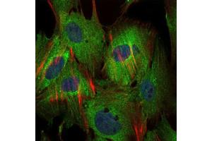 Immunofluorescence analysis of MSCS cells using BIRC5 antibody (green). (Survivin antibody)