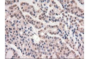 Image no. 15 for anti-Myc Proto-Oncogene protein (MYC) antibody (ABIN1497011) (c-MYC antibody)