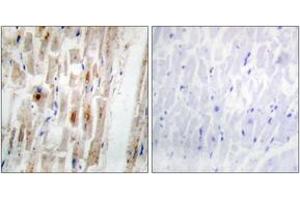 Immunohistochemistry analysis of paraffin-embedded human heart, using Smad1 (Phospho-Ser465) Antibody. (SMAD1 antibody  (pSer465))