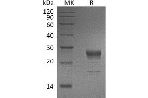 FGF7 Protein (His tag)