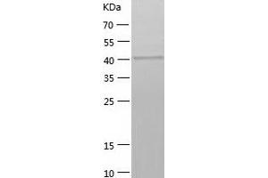 Western Blotting (WB) image for Sjogren Syndrome Antigen B (SSB) (AA 1-408) protein (His tag) (ABIN7125112)
