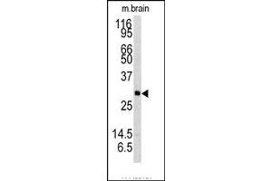Image no. 1 for anti-Neurotrophin 3 (NTF3) (C-Term) antibody (ABIN360064) (Neurotrophin 3 antibody  (C-Term))