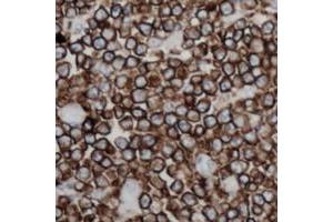 Immunohistochemical analysis of CD254 staining in human lymph node formalin fixed paraffin embedded tissue section.