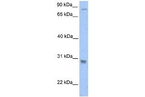 Western Blotting (WB) image for anti-Glutathione S-Transferase theta 1 (GSTT1) antibody (ABIN2459202) (GSTT1 antibody)