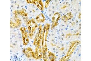 Immunohistochemistry of paraffin-embedded Rat kidney using SULT2A1 Polyclonal Antibody at dilution of 1:200 (40x lens). (SULT2A1 antibody)