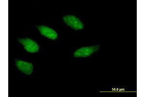 Immunofluorescence of purified MaxPab antibody to EGR2 on HeLa cell.