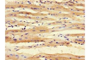 Immunohistochemistry of paraffin-embedded human heart tissue using ABIN7171028 at dilution of 1:100