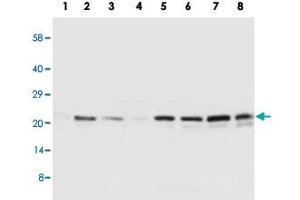 Western blot analysis of tissue and whole cell extracts with SOCS2 polyclonal antibody . (SOCS2 antibody  (C-Term))