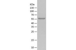 RGS14 Protein (AA 1-566) (His tag)