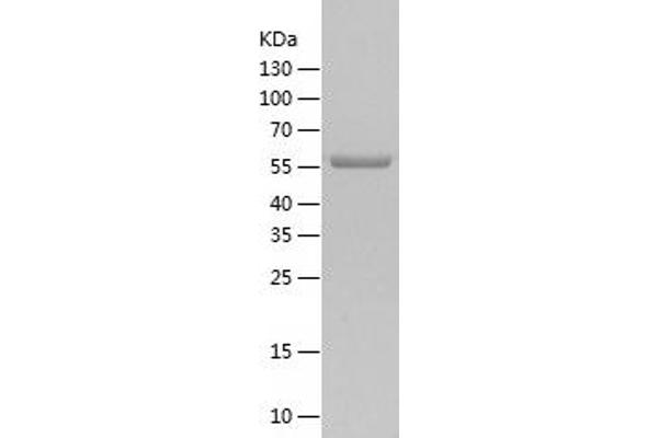 RGS14 Protein (AA 1-566) (His tag)