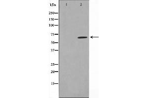 Western blot analysis on HeLa cell lysate using SGOL1 Antibody,The lane on the left is treated with the antigen-specific peptide. (Shugoshin antibody  (N-Term))