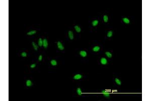 Immunofluorescence of purified MaxPab antibody to C11orf17 on HeLa cell. (AKIP1 antibody  (AA 1-210))