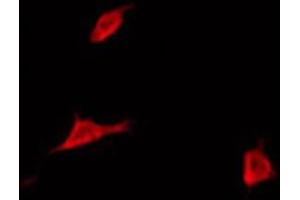 ABIN6272350 staining COLO205 by IF/ICC. (MYL12B antibody)