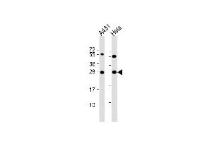 All lanes : Anti-PSPH Antibody (N-term) at 1:8000 dilution Lane 1: A431 whole cell lysate Lane 2: Hela whole cell lysate Lysates/proteins at 20 μg per lane. (PSPH antibody  (N-Term))