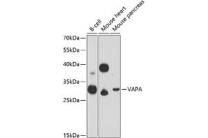 Western blot analysis of extracts of various cell lines, using VAPA Antibody (ABIN6132892, ABIN6150056, ABIN6150057 and ABIN6216758) at 1:3000 dilution. (VAPA antibody  (AA 137-227))