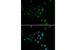 Immunofluorescence analysis of MCF7 cell using CPT2 antibody. (CPT2 antibody)