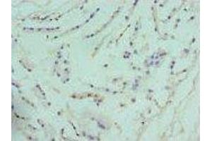 Immunohistochemistry (IHC) image for anti-Arginase, Type II (ARG2) (AA 1-354) antibody (ABIN6098038) (ARG2 antibody  (AA 1-354))