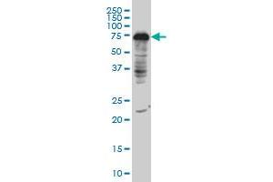 DCP1A monoclonal antibody (M06), clone 3G4 Western Blot analysis of DCP1A expression in IMR-32 (DCP1A antibody  (AA 186-285))