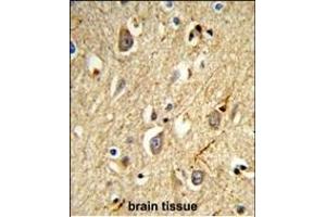 Immunohistochemistry (Paraffin-embedded Sections) (IHC (p)) image for anti-RAB8A, Member RAS Oncogene Family (RAB8A) antibody (ABIN1881723)