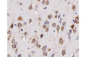 Immunohistochemistry analysis of parafffin-embedded rat brain using NTS Polyclonal Antibody at dilution of 1:300. (Neurotensin antibody)