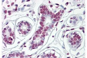 IHC Suggested Anti-HDAC2 antibody  Titration: 5ug/ ml Positive Control: Breast (HDAC2 antibody  (Middle Region))