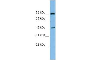 WB Suggested Anti-ZMYND12 Antibody Titration: 0.