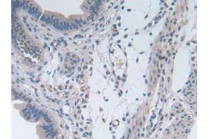 IHC-P analysis of Mouse Uterus Tissue, with DAB staining. (IL-2 antibody  (AA 10-169))