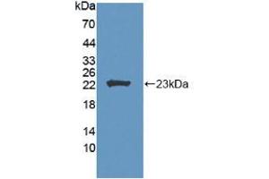 Western blot analysis of recombinant Human LCAT. (LCAT antibody  (AA 41-210))