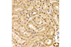 Immunohistochemistry of paraffin-embedded mouse kidney using ANP32A Antibody. (PHAP1 antibody  (AA 1-170))