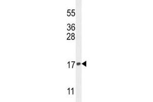 Western blot analysis of Histone H3. (Histone H3.3 antibody  (Lys9))