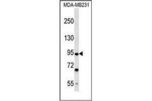 Western blot analysis of FSD2 Antibody (N-term) in MDA-MB231 cell line lysates (35ug/lane).