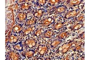 Immunohistochemistry of paraffin-embedded human small intestine tissue using ABIN7161885 at dilution of 1:100 (PPP1R9A antibody  (AA 1-243))