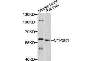 Western blot analysis of extracts of various cell lines, using CYP2R1 antibody (ABIN4903430) at 1:1000 dilution. (CYP2R1 antibody)