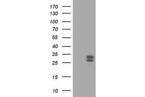 Image no. 4 for anti-O6-Methylguanine-DNA-Methyltransferase (MGMT) antibody (ABIN1499456) (MGMT antibody)