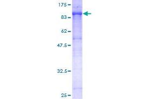 Image no. 1 for Endoglin (ENG) (AA 27-658) protein (GST tag) (ABIN1352796) (Endoglin Protein (ENG) (AA 27-658) (GST tag))