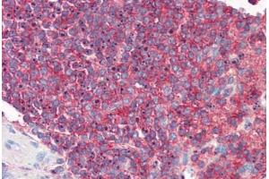 Human Spleen: Formalin-Fixed, Paraffin-Embedded (FFPE) (ICAM-3/CD50 antibody)