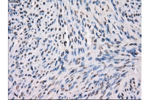 Immunohistochemical staining of paraffin-embedded Ovary tissue using anti-MAP2K1 mouse monoclonal antibody. (MEK1 antibody)