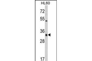 Western blot analysis of HLA-DRA Antibody (C-term) (ABIN390771 and ABIN2841029) in HL60 cell line lysates (35 μg/lane).
