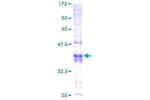 Image no. 1 for Chromosome 20 Open Reading Frame 7 (C20orf7) (AA 1-158) protein (GST tag) (ABIN1347433) (C20orf7 Protein (AA 1-158) (GST tag))