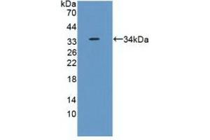 Detection of Recombinant RPS6Ka1, Human using Polyclonal Antibody to Ribosomal Protein S6 Kinase Alpha 1 (RPS6Ka1) (RPS6KA1 antibody  (AA 62-321))
