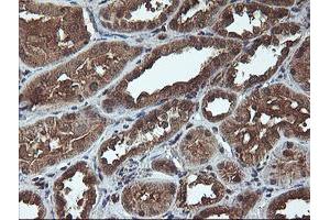 Immunohistochemical staining of paraffin-embedded Human Kidney tissue using anti-C1S mouse monoclonal antibody. (C1S antibody)