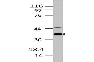 Image no. 1 for anti-MKI67 FHA Domain-Interacting Nucleolar Phosphoprotein (MKI67IP) (AA 90-210) antibody (ABIN5027394) (NIFK antibody  (AA 90-210))