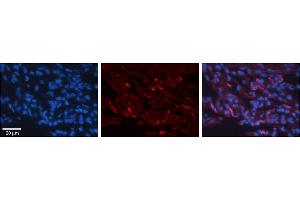 Immunohistochemistry (IHC) image for anti-Glucose-6-Phosphate Dehydrogenase (G6PD) (N-Term) antibody (ABIN2784459)